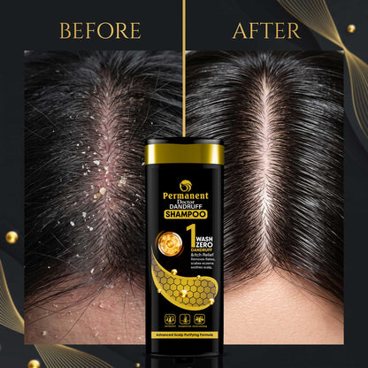 Permanent Doctor Dandruff Shampoo – 250ml