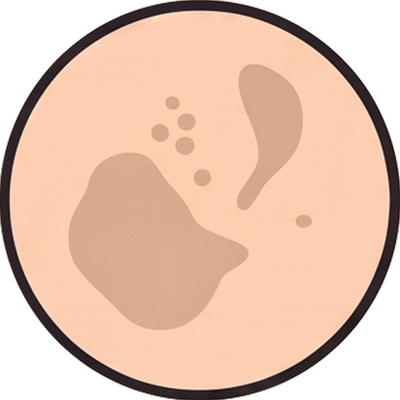 Pigmentation Kit
