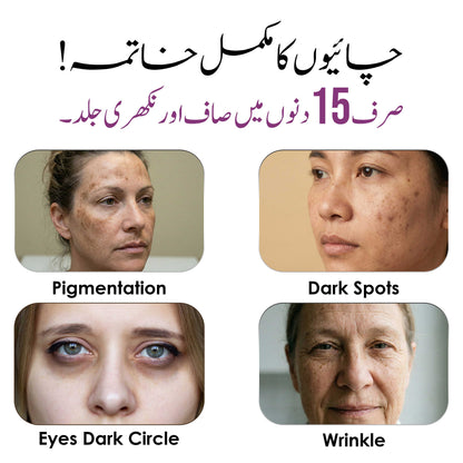 Permanent Pigmentation Control Kit (Cream +Facewash + Serum) + Free Gift